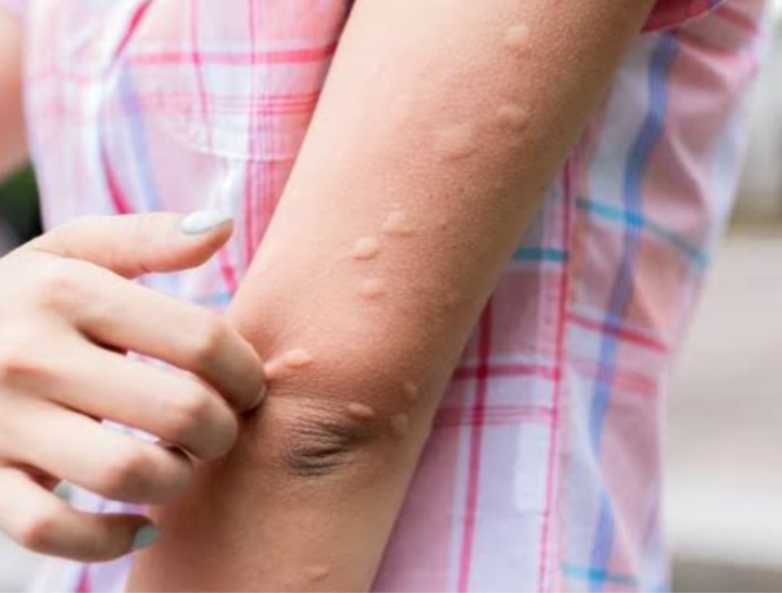 Jangan anggap remeh Kamitetep, Ini Fakta Terbarunya
