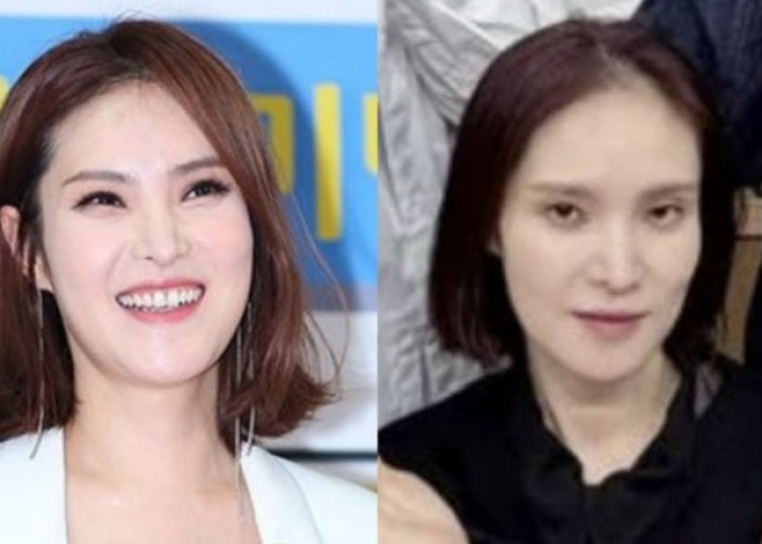 Wajah Gummy Terlihat Lembek 'Kekhawatiran tentang Kesehatannya' Bermunculan