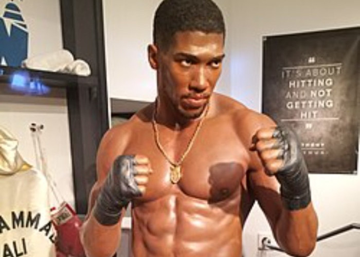 Petinju Anthony Joshua asal Inggris akhirnya Dibolehkan Keluar RS Pasca Kecelakaan