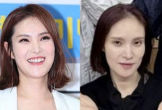 Wajah Gummy Terlihat Lembek 'Kekhawatiran tentang Kesehatannya' Bermunculan